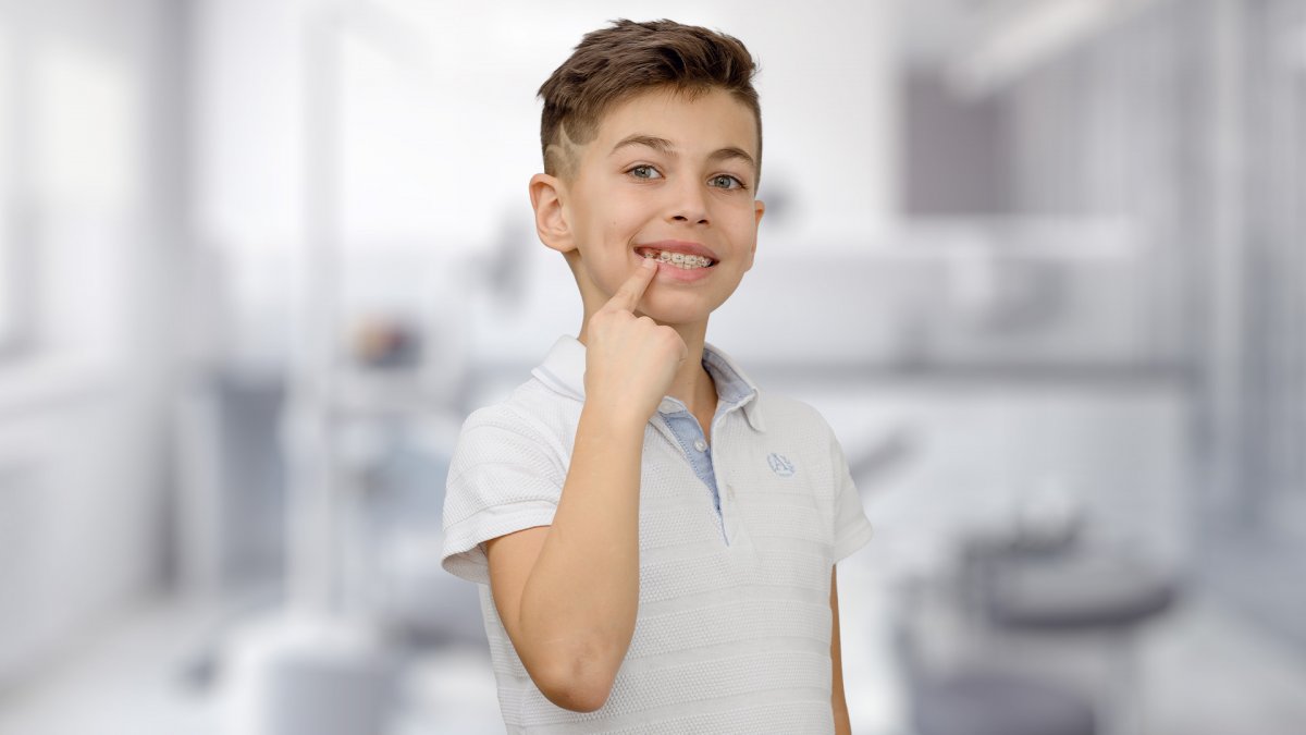 С какого возраста можно ставить брекеты детям?