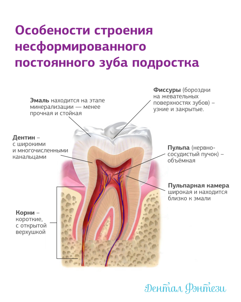 Лечение кариеса у подростков