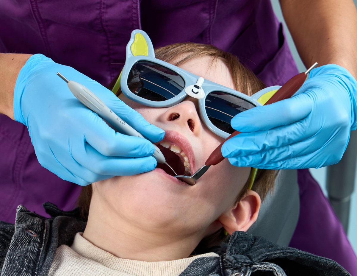 Что делать если у ребенка появился кариес